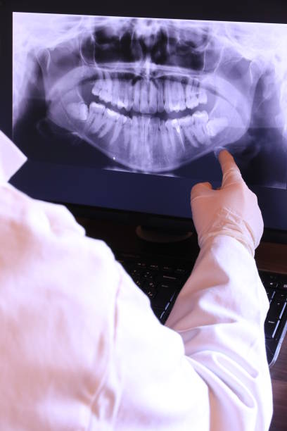 Best Emergency Dental Extractions in Bannockburn, IL