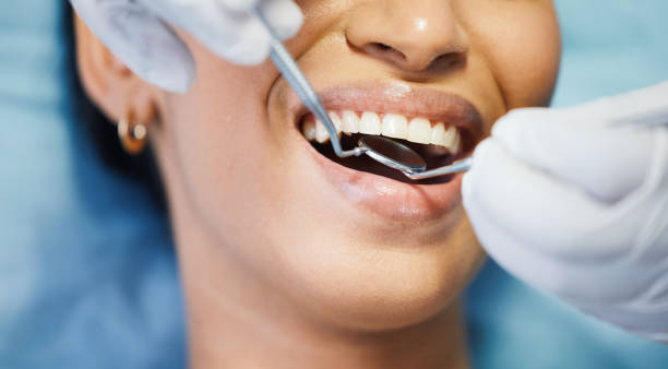 Best Broken or Cracked Tooth Emergency Dentist in Bannockburn, IL